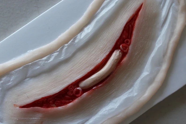 Exposed Slit Throat Prosthetic - Image 4