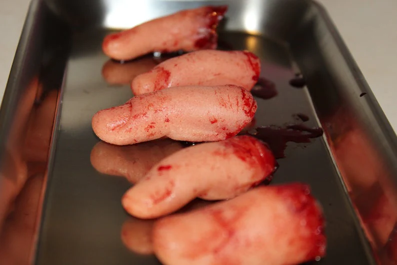Severed Fingers on Medical Tray Display - Image 6