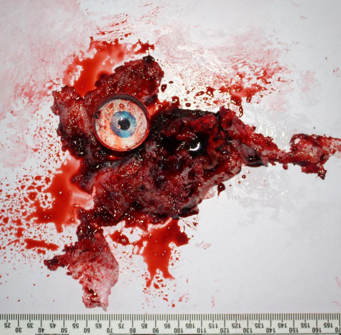 Traumatic Body Tissue Prop - Image 2
